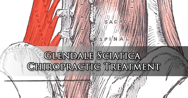 Glendale Sciatica Chiropractic Treatment