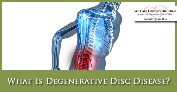 What Is Degenerative Disc Disease - We Care Chiropractic Blog