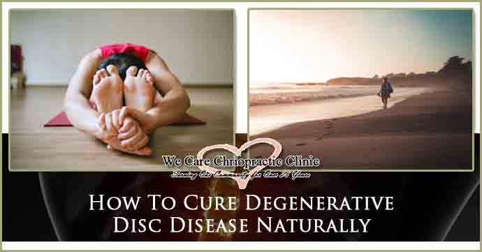 How To Cure Degenerative Disc Disease Naturally