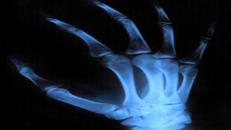 Chiropractic Care And Hand Pain