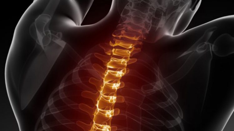 Car Accident Chiropractor Glendale