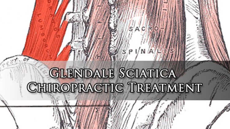 Glendale Sciatica Chiropractic Treatment