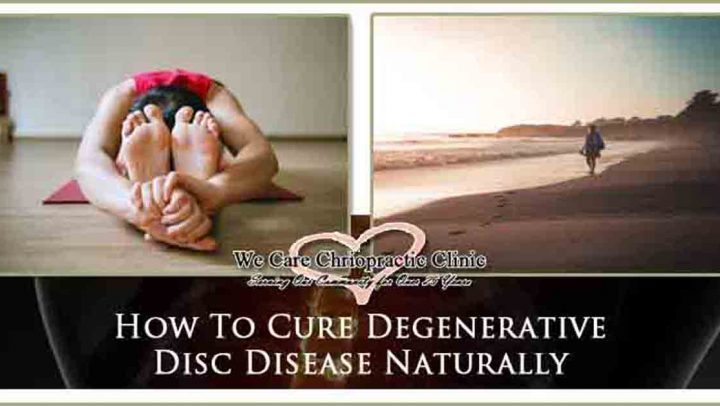 how-to-cure-degenerative-disc-disease-naturally-we-care-chiropractic