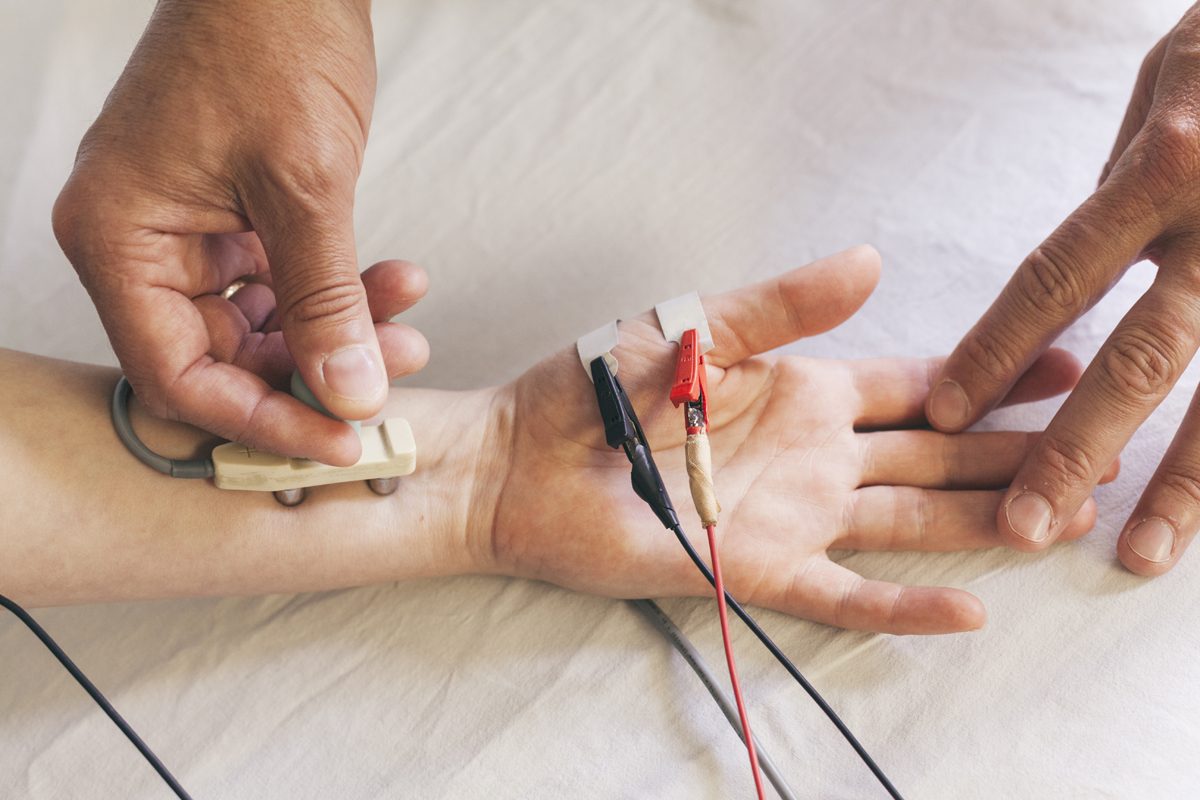 Why Do Chiropractors Use Electrical Stimulation?